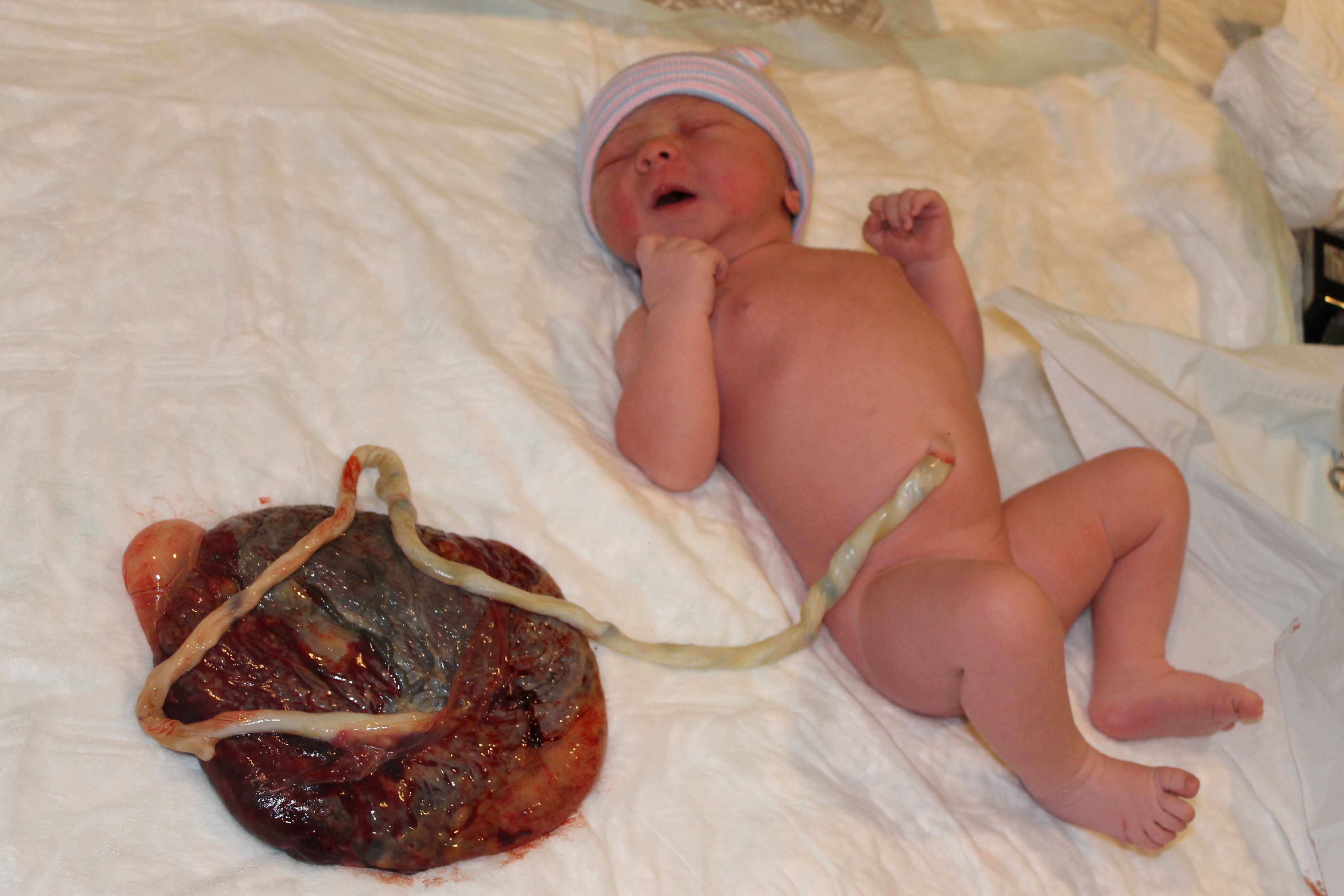 birth placenta 